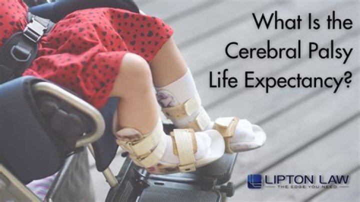 Alex Yood Disability: Does He Have Cerebral Palsy?