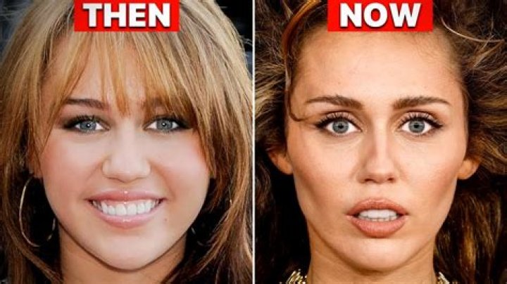 Emily Compagno Plastic Surgery, Did She Get Plastic Surgery Done? |