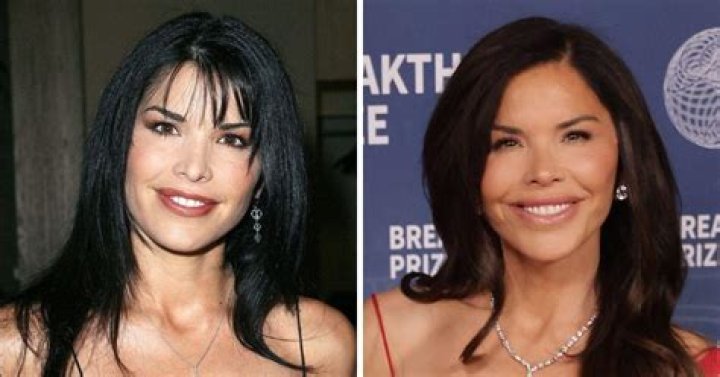 Fivel Stewart Plastic Surgery; Before And After Photos