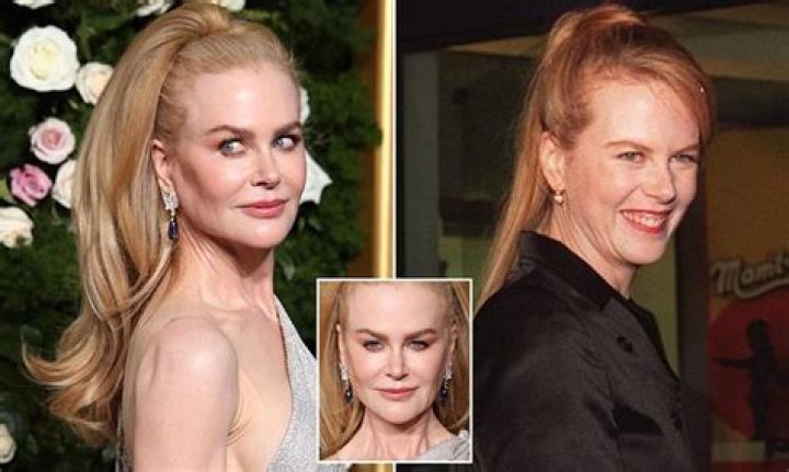 Has Nicole Kidman Undergone A Facelift? Examining The Evidence