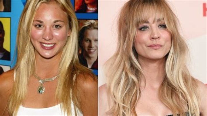 Kaley Cuoco Botox: Before And After Photos