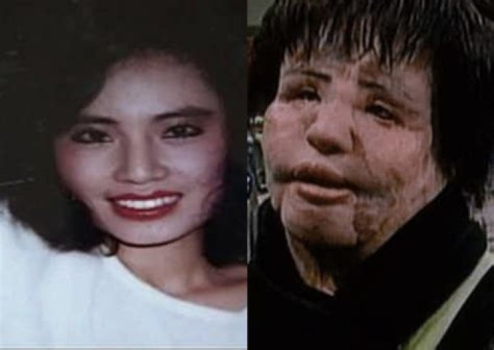 Know about Hang Mioku's Plastic Surgery Story, Life Now, Death Rumors, Age & Net Worth