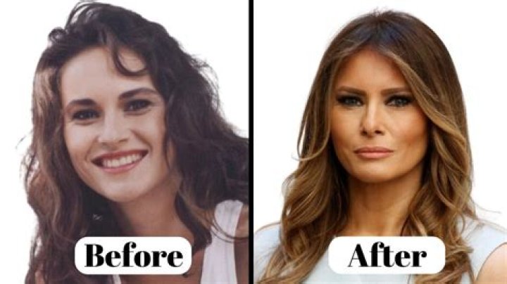 Lilah Gibney Before Surgery: Did She Get Top Or Bottom Surgery?