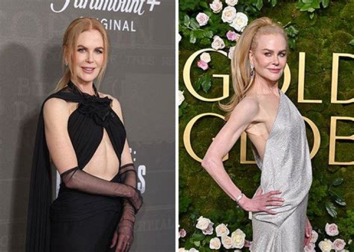 Nicole Kidman's Weight Loss Journey: Secrets Revealed