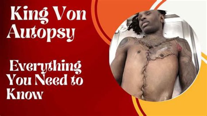 See The Shocking Aftermath: King Von's Autopsy Photos Revealed