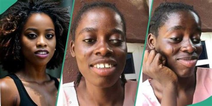 "Social Media VS Reality": Lady Exposes Her Real Face, Shows Tribal Marks After Posting Edited Photo