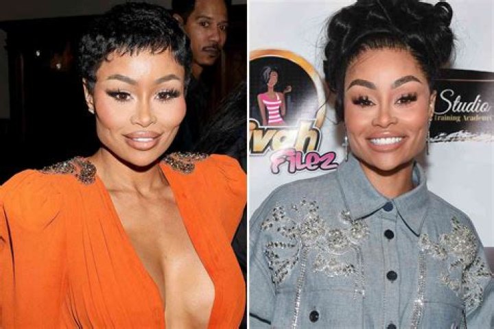 Unveil The Evolution Of Blac Chyna: Before And After