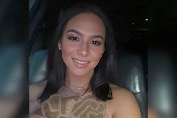 What Happened To Rhea Santos Legs? Plastic Surgery